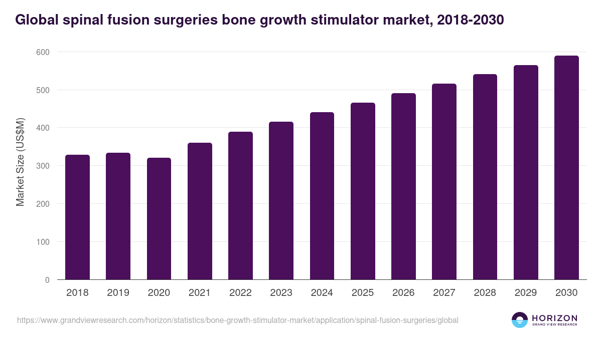 Global spinal fusion surgeries bone growth stimulator market statistics, 2018-2030 (US$M)