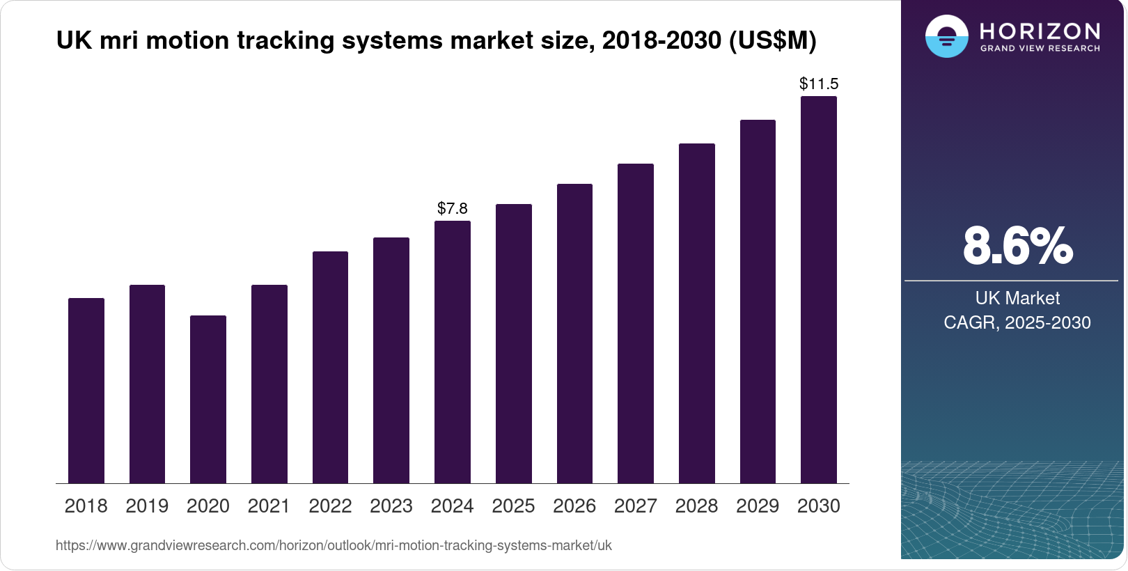 UK MRI Motion Tracking Systems Market Size & Outlook, 2030
