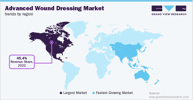 Advanced Wound Dressing Market Trends by Region
