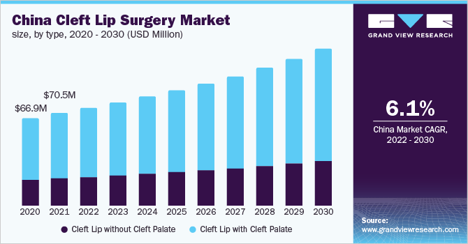 China cleft lip surgery market size, by type, 2020 - 2030 (USD Million)