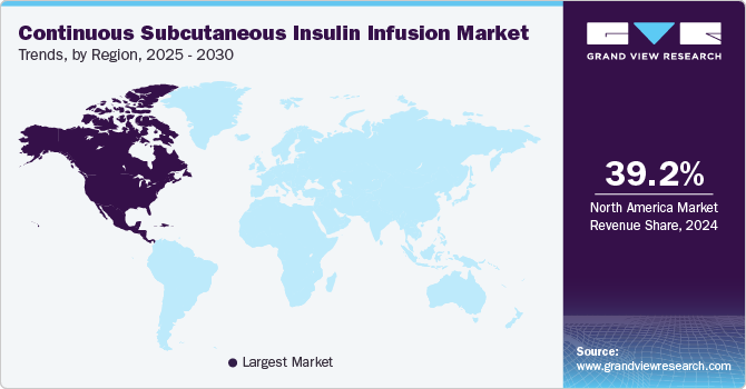 Continuous Subcutaneous Insulin Infusion Market Trends, by Region, 2025 - 2030 Continuous Subcutaneous Insulin Infusion Market Trends, by Region, 2025 - 2030