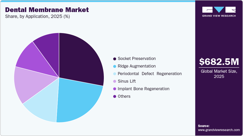 Dental Membrane Market Share