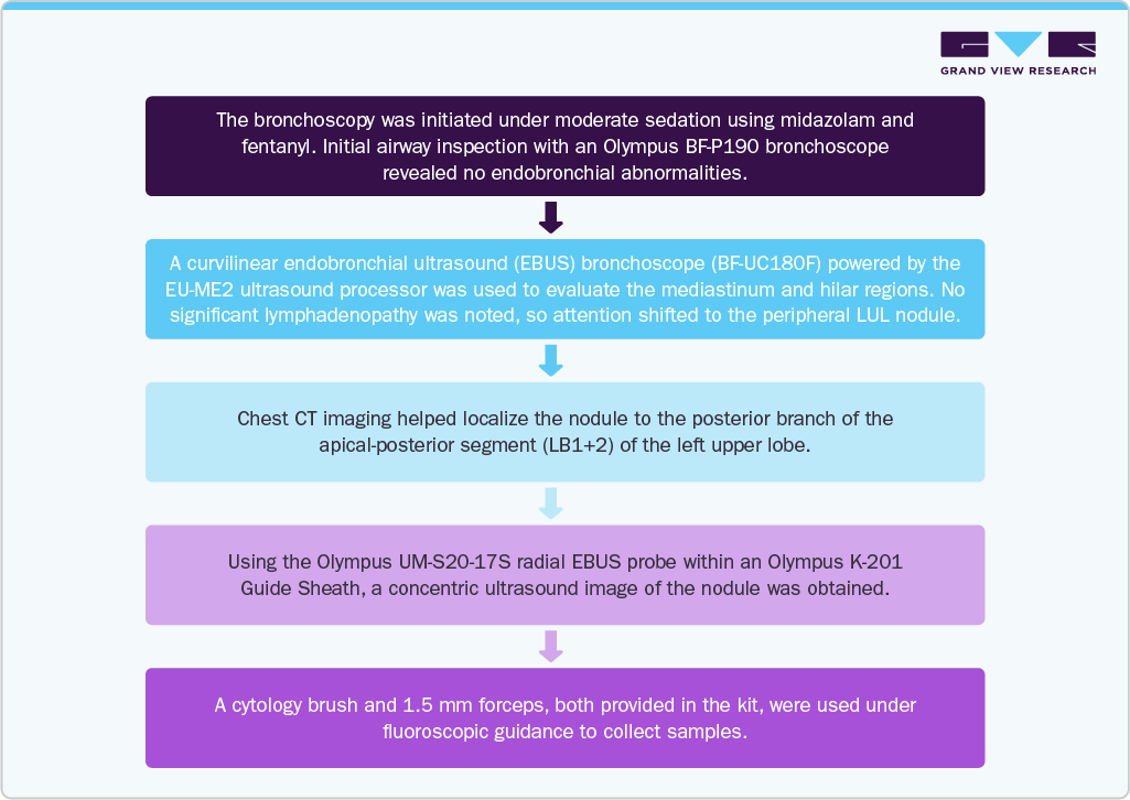 Endobronchial ultrasound biopsy market Case Study: 