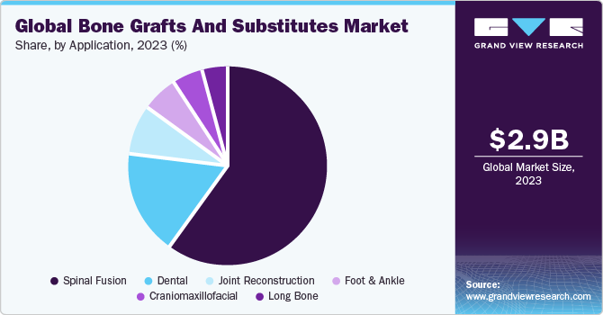 Global bone grafts & substitutes market share and size, 2022