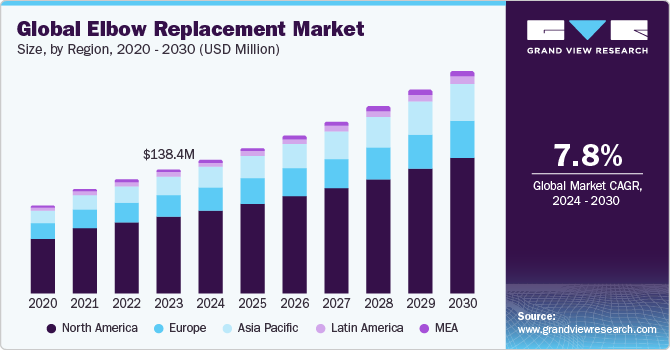 Global Elbow Replacement Market Size, By Region, 2020 - 2030 (USD Million)