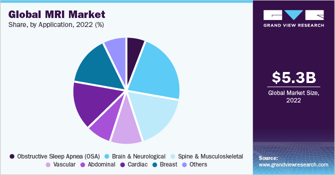Global MRI market share and size, 2022