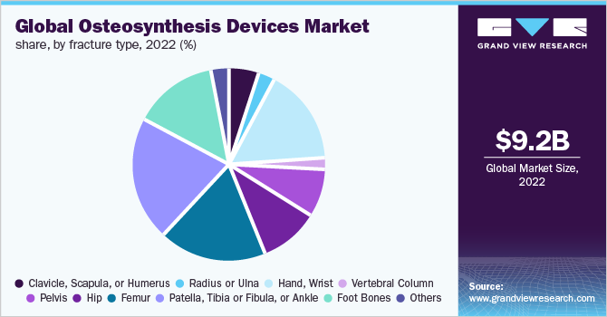 Global osteosynthesis devices market share, by fracture type, 2022 (%)