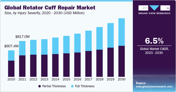 Global Rotator Cuff Repair Market Size, By Injury Severity, 2020 - 2030 (USD Million)