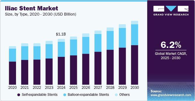 Iliac Stent Market size and growth rate, 2025 - 2030