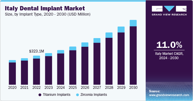 Italy Dental Implant Market size and growth rate, 2024 - 2030 Italy Dental Implant Market size and growth rate, 2024 - 2030