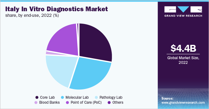 Italy in vitro diagnostics market share, by end-use, 2022 (%)