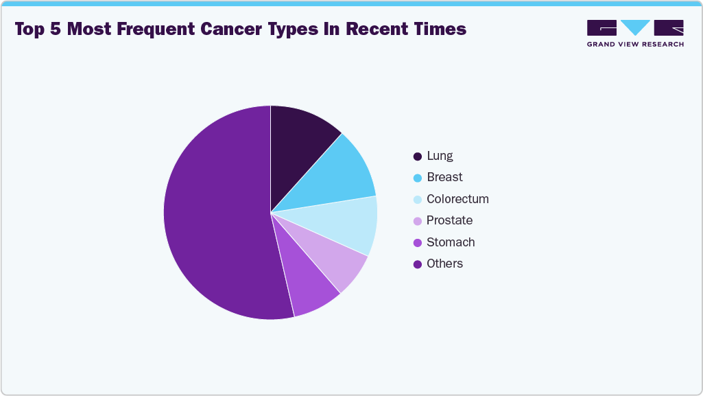 Top 5 most frequent cancer types in recent times Top 5 most frequent cancer types in recent times