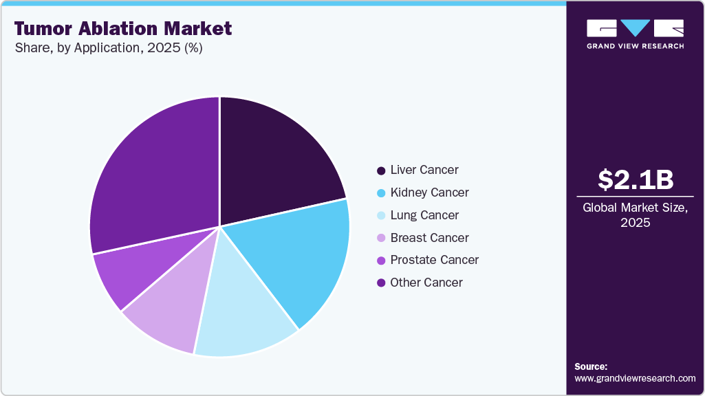 Tumor Ablation Market Share
