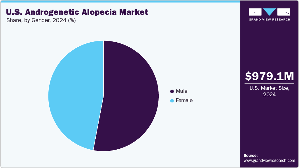 U.S. Androgenetic Alopecia Market Share