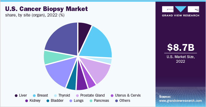  U.S. cancer biopsy market share, by site (organ), 2022 (%)